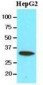 CBR3 Antibody (clone AT3C5)